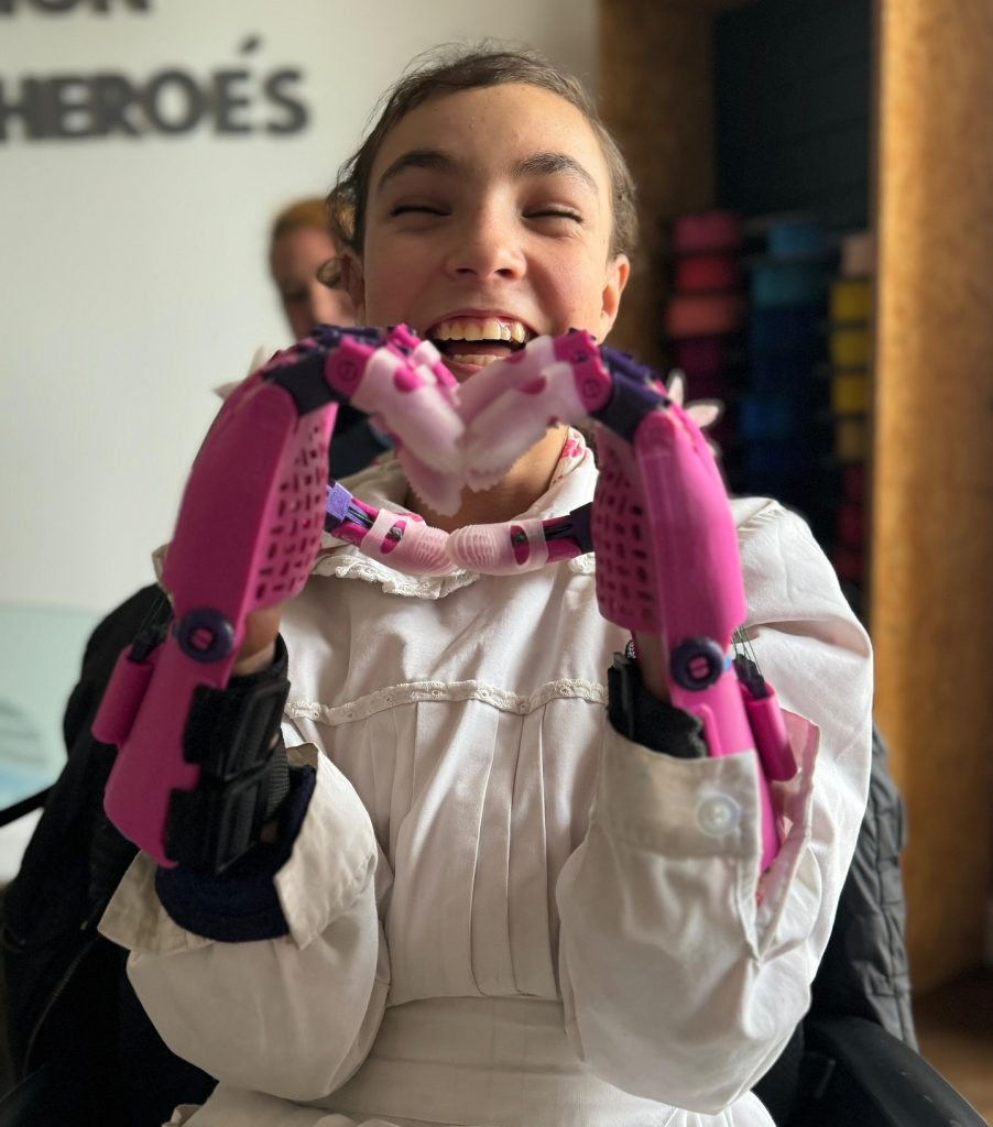 Prótesis impresión 3D