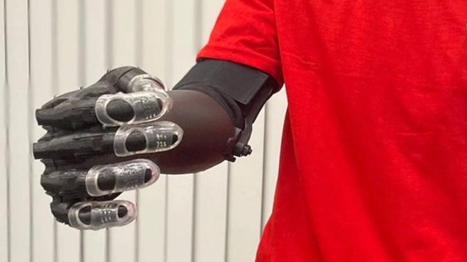 Protésis plásticas con impresión 3D