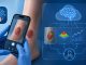 WoundAIssist inteligencia artificial en el monitoreo de heridas